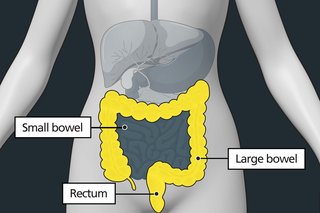 Diagram of the tummy area with labels showing the small bowel, large bowel and rectum. The large bowel and rectum are highlighted to show they can be affected by bowel cancer.